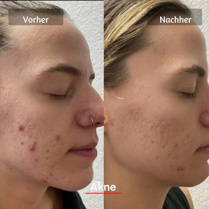 LED PRO Gesichtsmaske – 10-minütige Lichttherapie gegen Falten und müde Haut