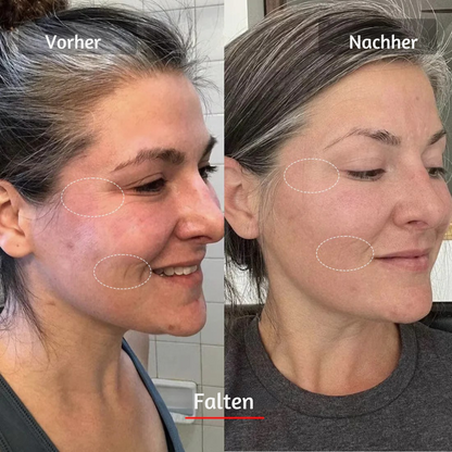 LED PRO Gesichtsmaske – 10-minütige Lichttherapie gegen Falten und müde Haut