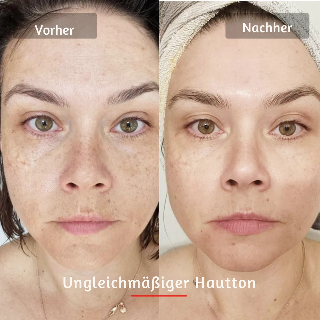 LED PRO Gesichtsmaske – 10-minütige Lichttherapie gegen Falten und müde Haut