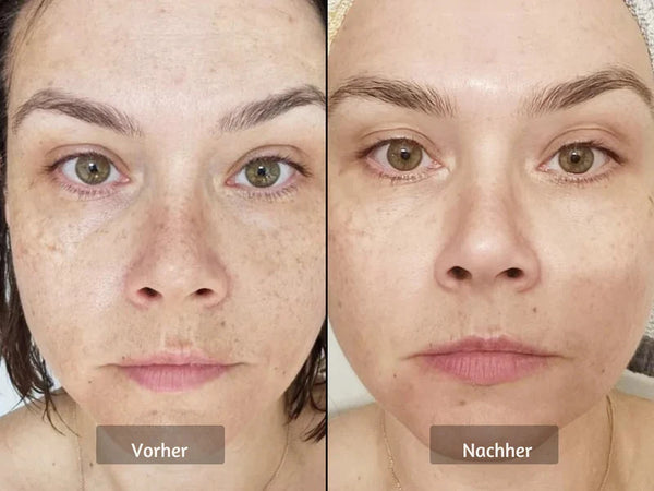 Gleichmäßigere Gesichtsfarbe